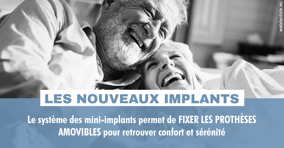 https://www.chirurgien-maxillo-facial-rouen.fr/Les nouveaux implants 2