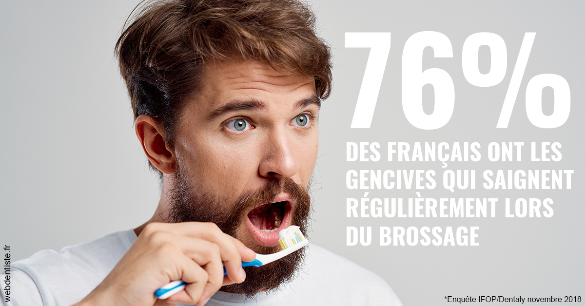 https://www.chirurgien-maxillo-facial-rouen.fr/76% des Français 2