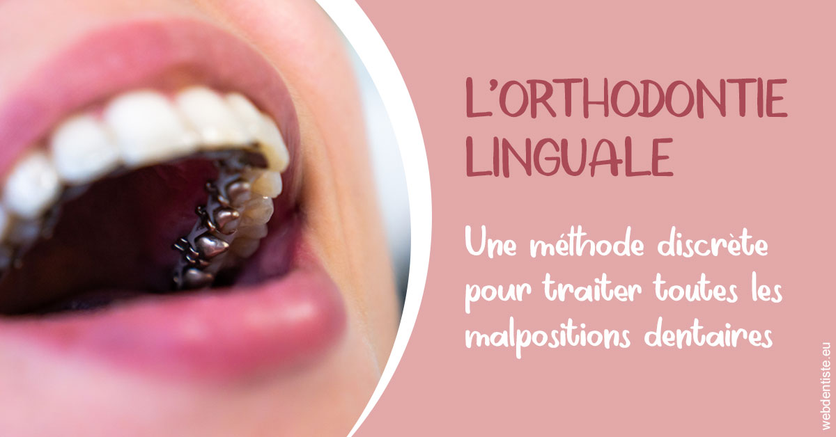 https://www.chirurgien-maxillo-facial-rouen.fr/L'orthodontie linguale 2