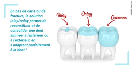 https://www.chirurgien-maxillo-facial-rouen.fr/L'INLAY ou l'ONLAY