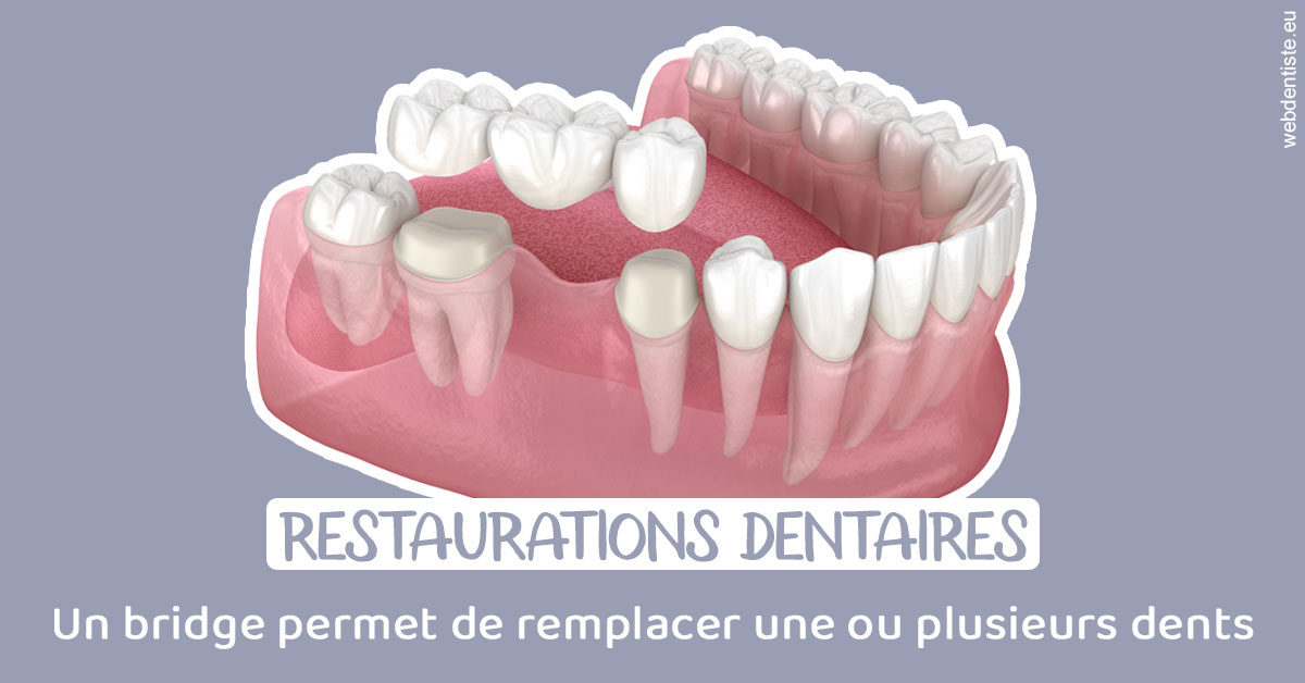 https://www.chirurgien-maxillo-facial-rouen.fr/Bridge remplacer dents 1