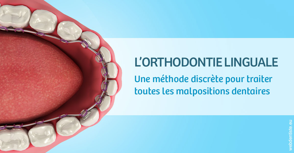https://www.chirurgien-maxillo-facial-rouen.fr/L'orthodontie linguale 1