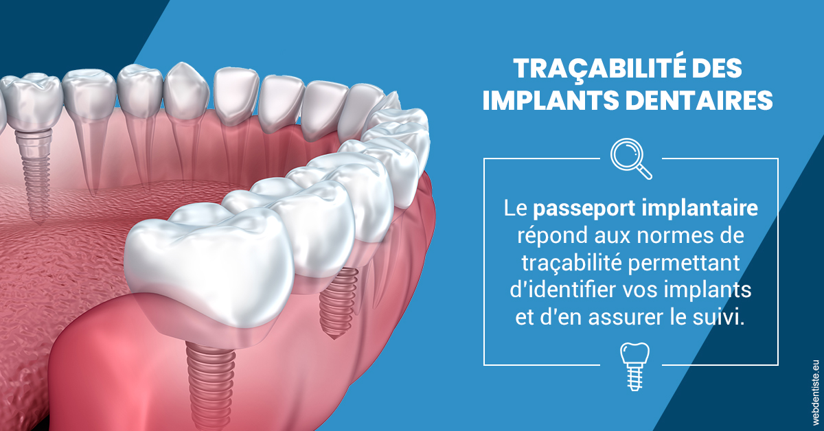 https://www.chirurgien-maxillo-facial-rouen.fr/T2 2023 - Traçabilité des implants 1