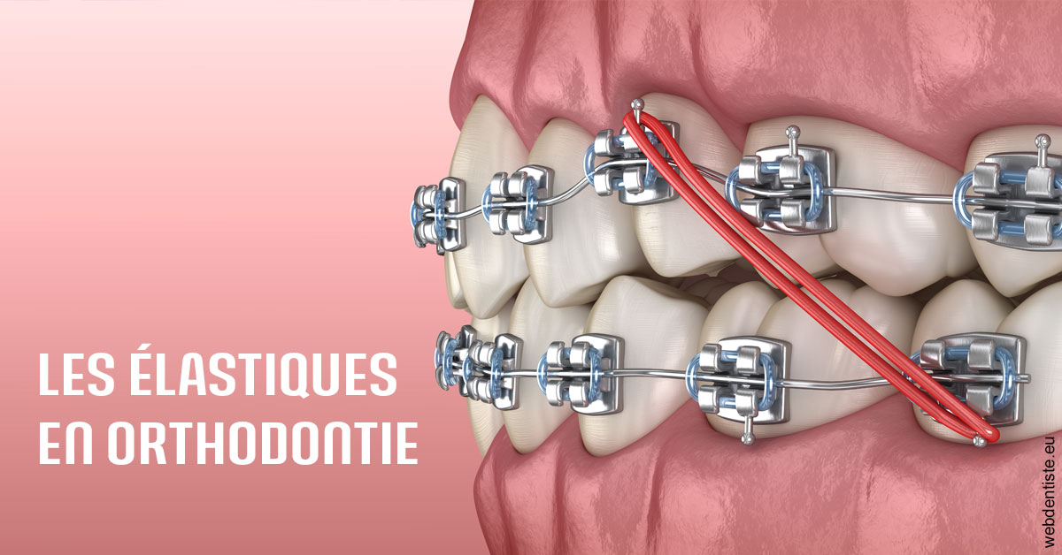 https://www.chirurgien-maxillo-facial-rouen.fr/Elastiques orthodontie 2